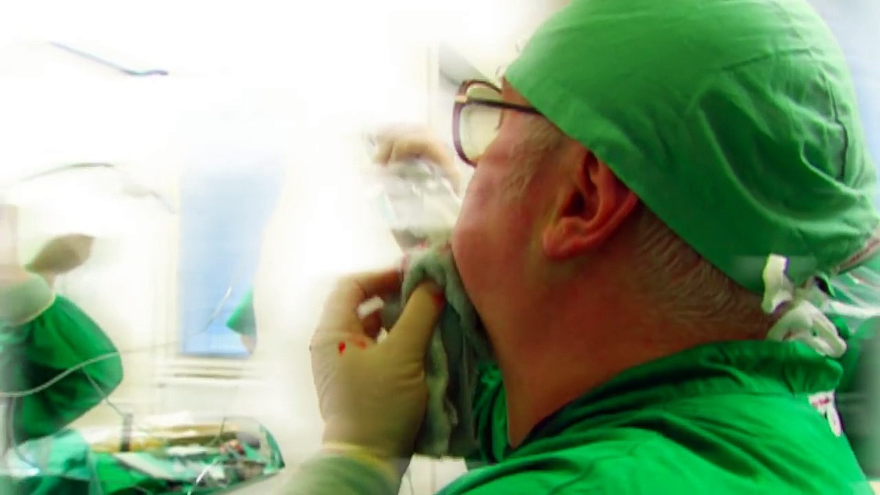 Selfie liposuction