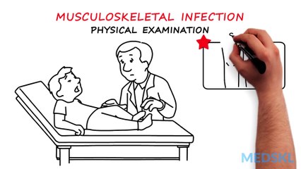 Orthopedics - Limp in Children - Whiteboard