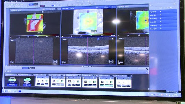 Últimos avances y estudios sobre la retina y el vítreo