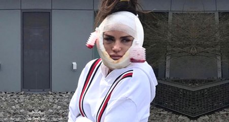 Güzellik İçin Yüz Ameliyatı Olan Şarkıcı Katie Price'ın Son Hali Korkuttu