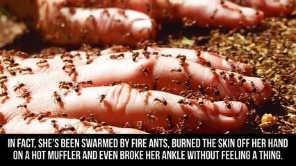 TEN UNBREAKABLE PEOPLE WHO FEEL NO PAIN