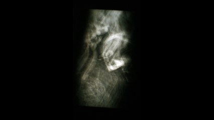 Composants électriques d'un circuit imprimé