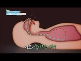[Happyday] Risk disease : Obstructive sleep apnea syndrome [기분 좋은 날] 0160715