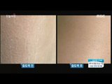 [Morning Show]skin cell, Use loess! 각질, 황토로 밀어내자! [생방송 오늘 아침] 20171024