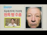 [Happyday] Danger of UV rays 주름의 주범은 '자외선' !? [기분 좋은 날] 20160513