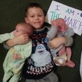 Brave 4-Year-Old Volunteers To Donate Bone Marrow To Save His Twin Brothers