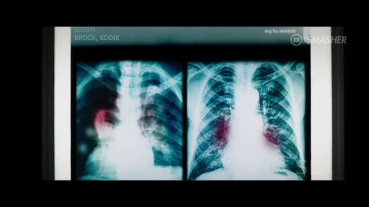 VENOM (2018).Fodoool.com