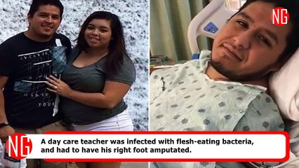 Day Care Teacher Lost Right Foot Due To Flesh-Eating Bacteria