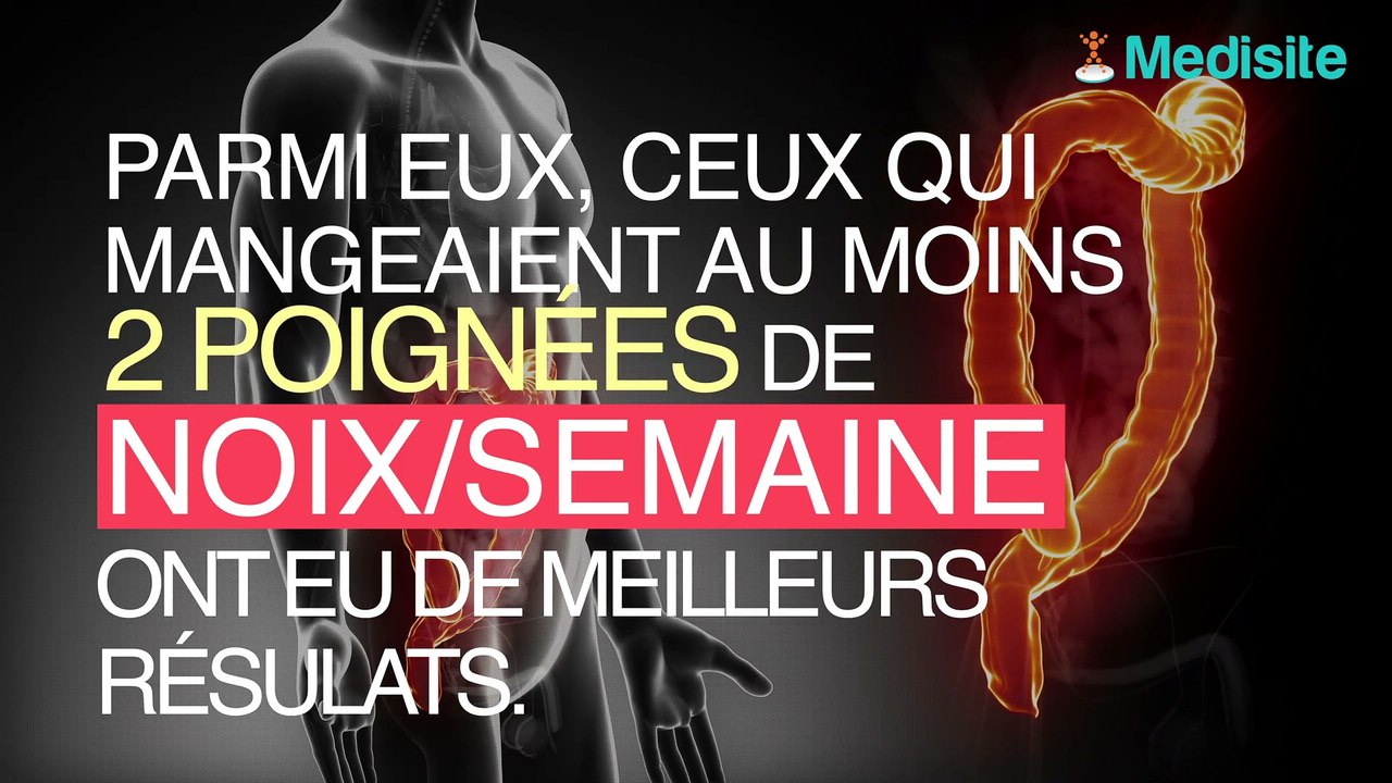Manger des noix réduirait la récidive de cancer du côlon