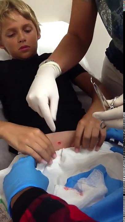 Warning: 11 year old gets a Punch Biopsy