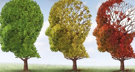 Alzheimer Kontrol Edilebilir Bir Hastalığa Dönüşüyor