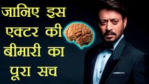 Irrfan Khan: Actor is suffering from Brain Cancer, Actual reason behind deadly disease|FilmiBeat