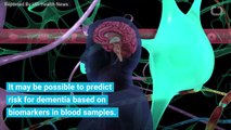 Risk Of Dementia May Soon Be Discovered Via Blood Test