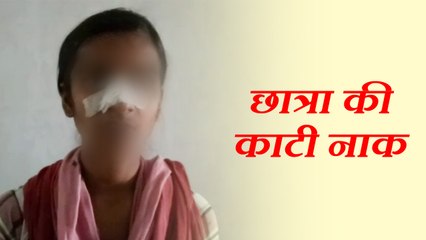 छेड़छाड़ का विरोध करने पर छात्रा की काटी नाक, देखें VIDEO