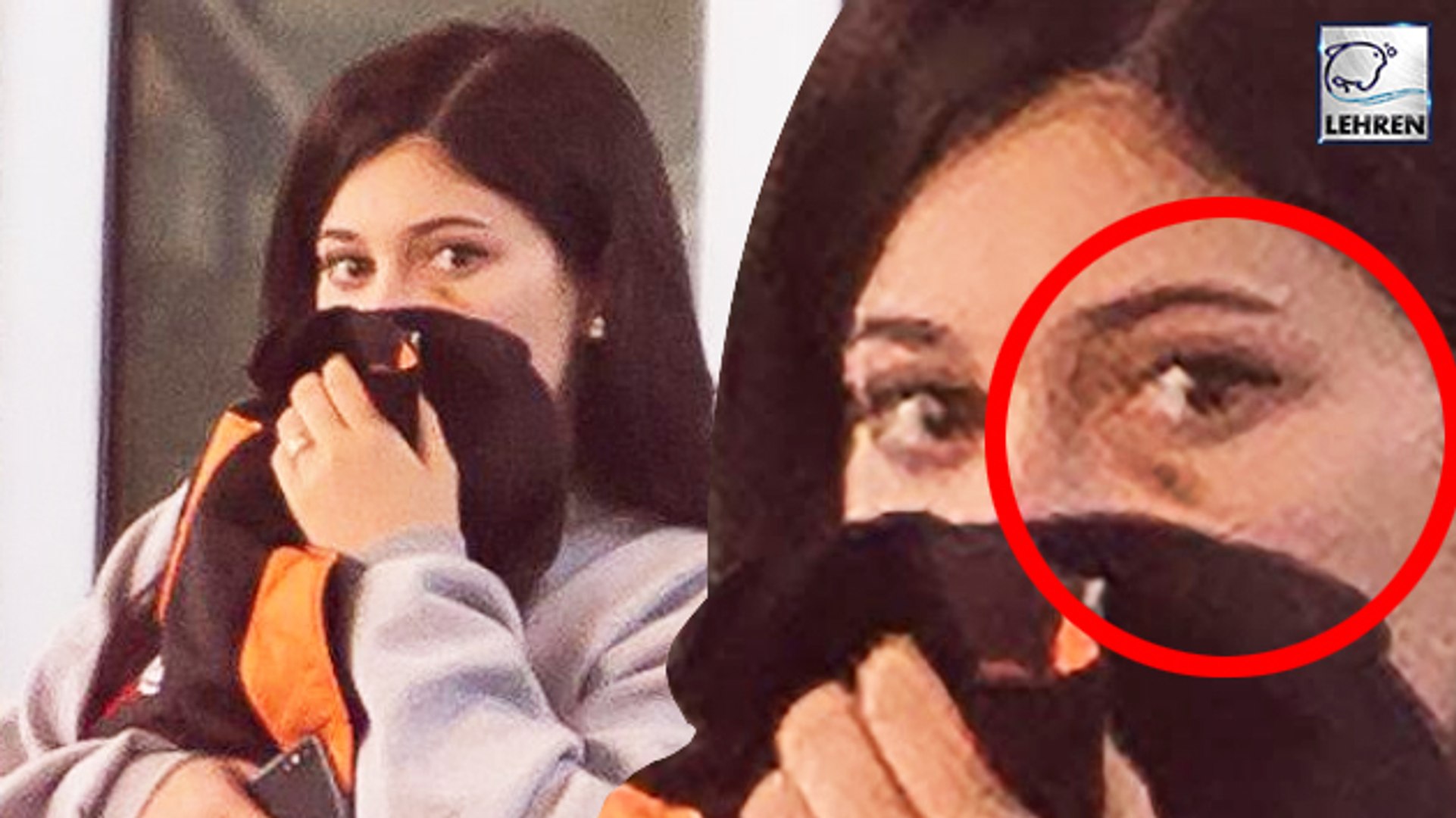 Kylie Jenner Seen With A Weird Mark Below Her Eye As She Hides Her Face