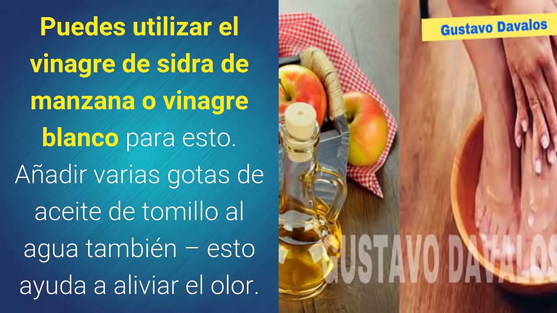 Actualizar 63+ images vinagre de manzana para pie de atleta Viaterra.mx