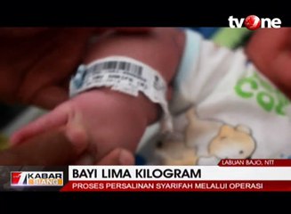 Ibu Lahirkan Bayi Seberat 5 Kilogram