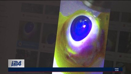 Myopie, hypertropie : bientôt des gouttes pour améliorer la vue