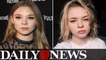 Taylor Hickson sues producers over face-disfiguring injury