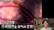 [HOT] 컬투의 베란다쇼 - 모기가 인간의 모세혈관 찾아 흡혈하는 모습 공개! 20130821