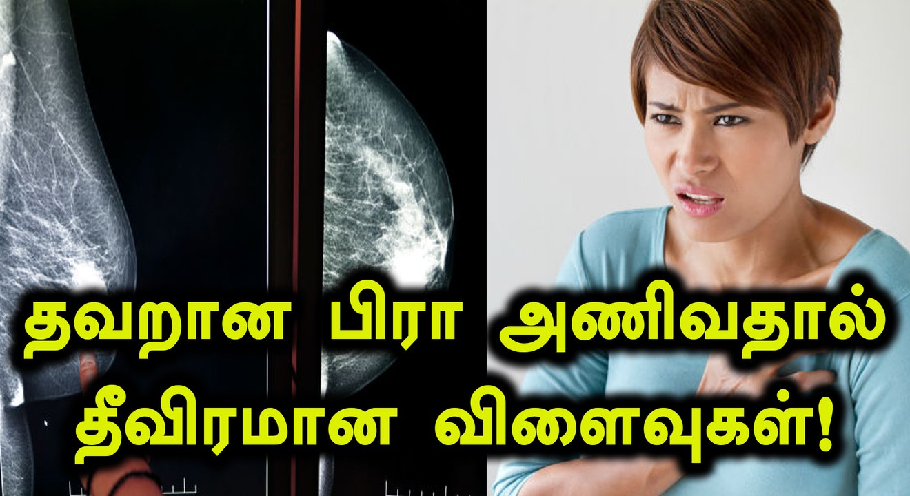 அணியும் பிரா சரியாக இல்லாவிட்டால், நிலைமை மோசமாகிவிடும்- வீடியோ