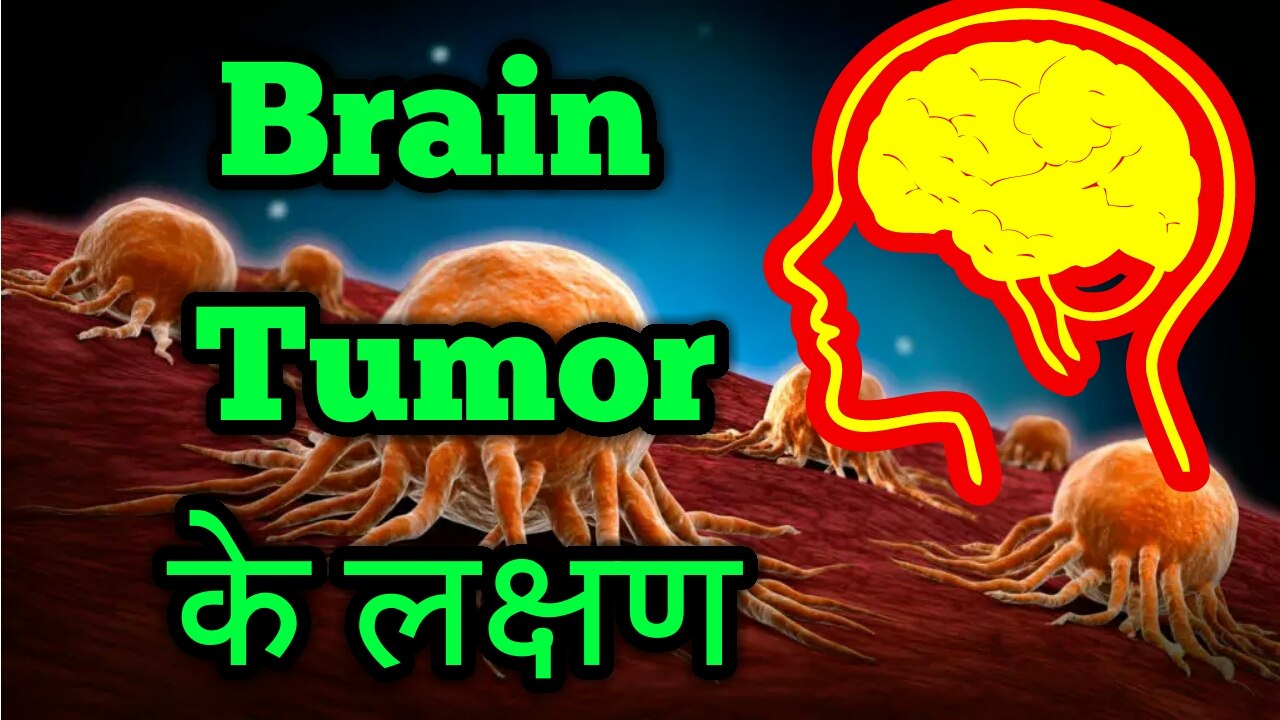 Symptoms of Brain Tumor and Brain Cancer (लक्षण)।