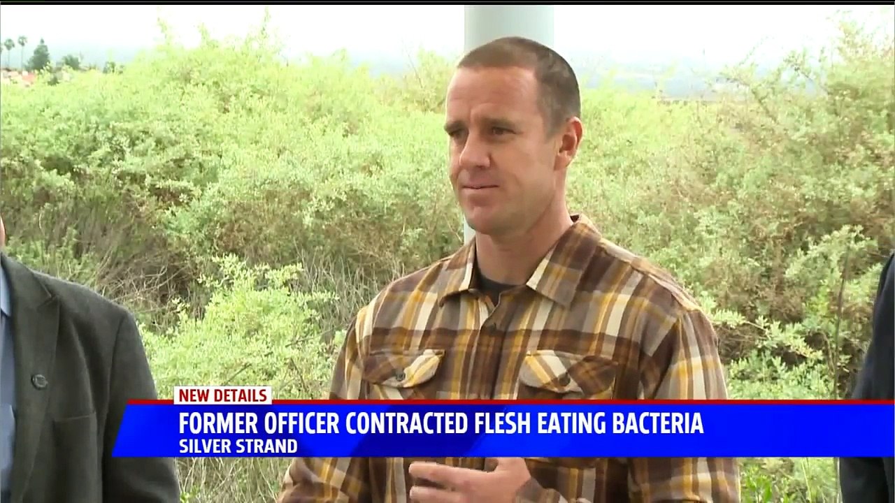 Former Officer Speaks Out After Contracting Flesh-Eating Bacteria in San Diego
