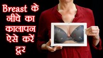 Breast के नीचे के कालेपन को दूर करने के उपाय | Dark Skin under Breast | Boldsky