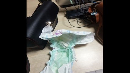 Bebeğin üzerindeki bezde eroin sakladılar