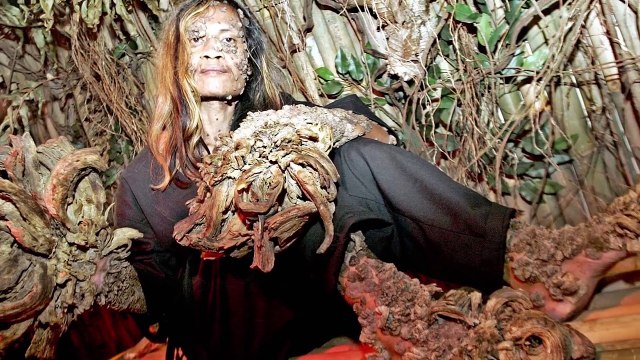 Las 10 Mutaciones Genéticas Más Extrañas Del Mundo