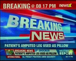 Shocking medical apathy in Jhansi; Patient's amputated leg used as pillow
