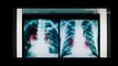 Marvel's VENOM (2018) Full Trailer #1 - Tom Hardy Marvel Movie [HD] Concept