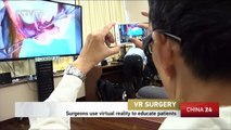 VR surgery: Surgeons use virtual reality to educate patients