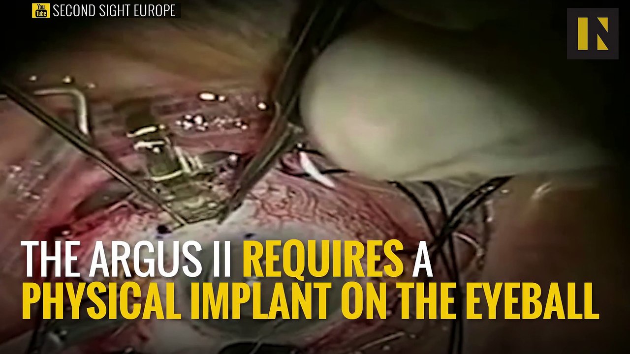 Making A Bionic Eyeball For The Blind