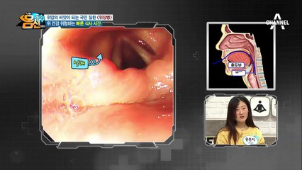 (신기) 내시경 따라 들어가는 몸속 탐험! 어 이거? '신기한 ㅇㅇ버스'아닌가요?