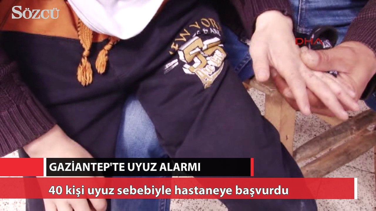 Gaziantep’te uyuz alarmı