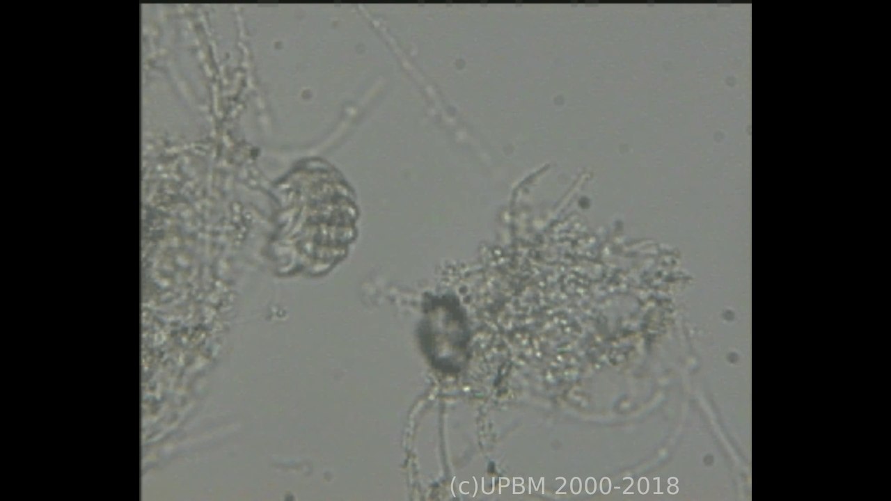 Aspidisca