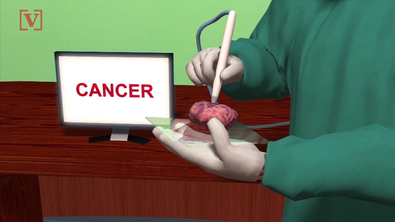 Report: Scientists Have Developed a Pen That Can Detect Cancer in Seconds