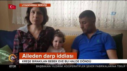 1,5 yaşındaki bebeğe kreşte darp