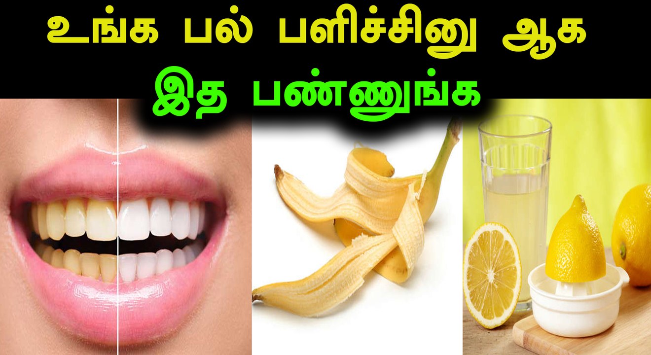 மஞ்சள் கரை நீங்கி வெண்மையான பற்கள் வேண்டுமா?- வீடியோ