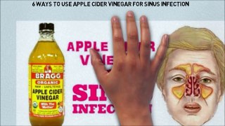6 Ways To Use Apple Cider Vinegar For Sinus Infection