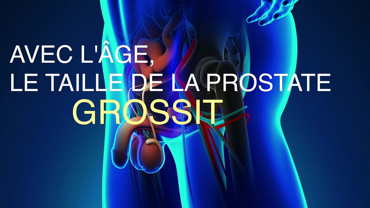 Hyperplasie Prostate