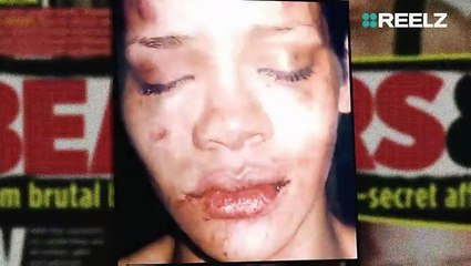 Rihanna Slams Snapchat Over Domestic Violence Ad: ‘Shame On You!’