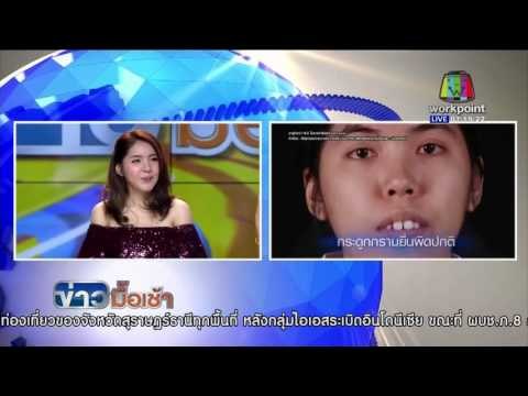 ข่าวมื้อเช้า | เปิดใจ หลิน สาวศัลยกรรม Let Me In Thailand คนแรก กับชีวิตใหม่ | 18 ม.ค. 59