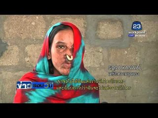 นักสิทธิฯ ปากีสถาน หมุนให้ยุบ คกก.กฏอิสลาม  l ข่าวรอบวัน l 18 กพ 59