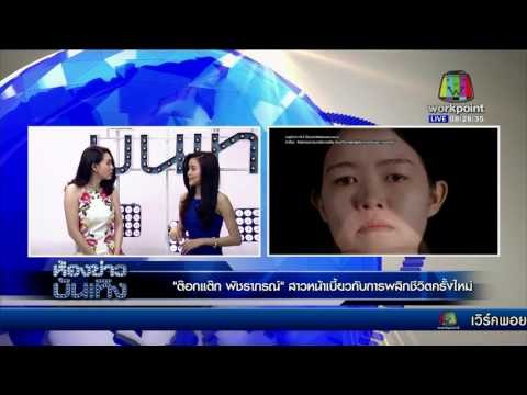 ข่าวมื้อเช้า | เปิดใจ ต๊อกแต๊ก พัชราภรณ์ สาวหน้าเบี้ยว Let Me In Thailand | 14 มี.ค. 59