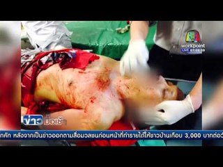 ทวงหนี้เดือดแทงเลือดสาดคาเทศบาลปากน้ำโพ l ข่าวมื้อเช้า l 6 เม.ย. 59