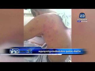 หนุ่มกรุงเก่าถูกต่อเสือนับร้อย รุมต่อย เสียชีวิต l ข่าวรอบวัน | 5 พ.ค. 59