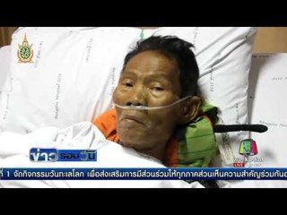 “ดอน จมูกบาน” อาการดีขึ้น พูดได้แล้ว | ข่าวรอบวัน | 08 มิ.ย. 59