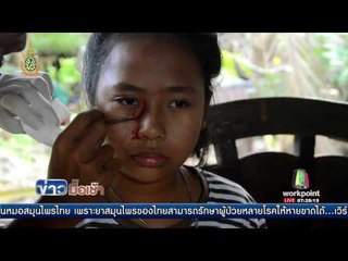 ด.ญ. 11 ขวบ ป่วยประหลาด เลือดออกตามตัว – หน้า l ข่าวมื้อเช้า l 18 ก.ค.59